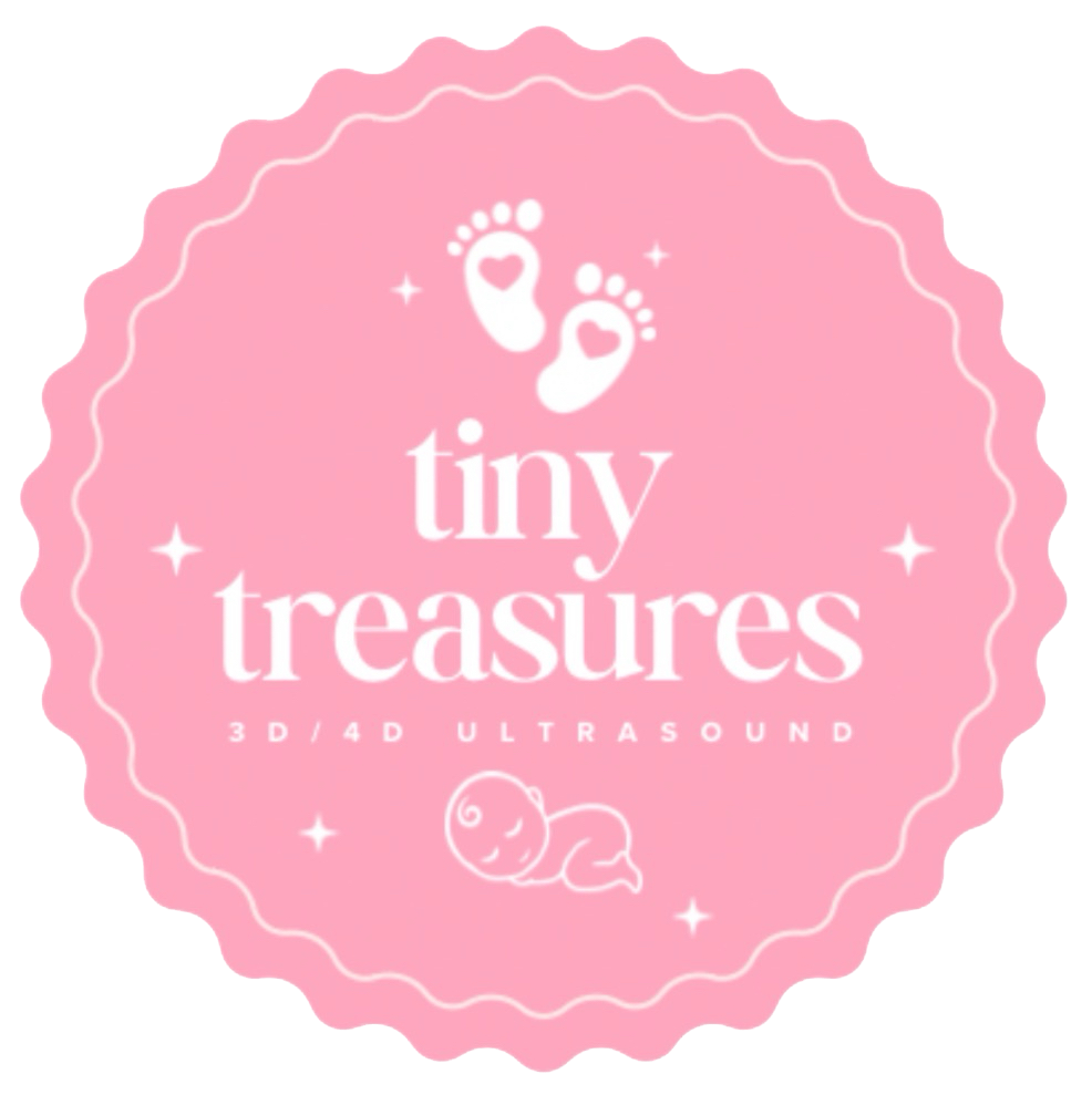 tiny treasures logo